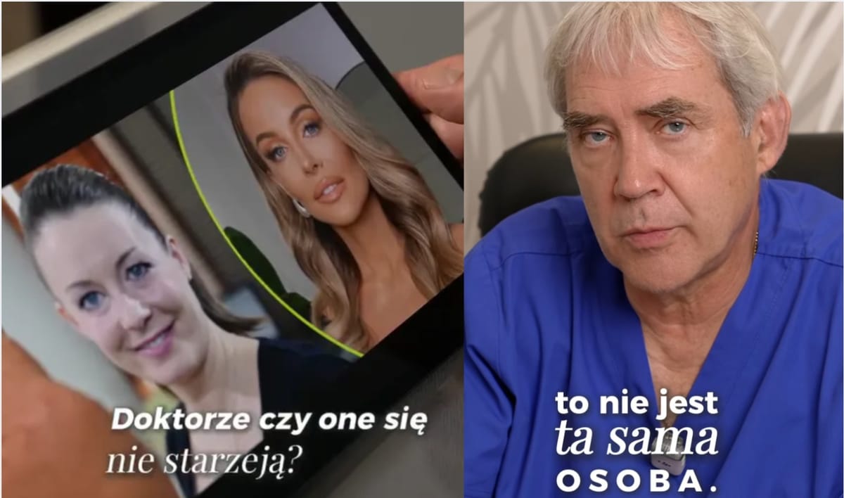 „To nie ta sama osoba”. Lekarz ocenił twarz Małgorzaty Rozenek po zabiegach Zdjęcie główne wpisu