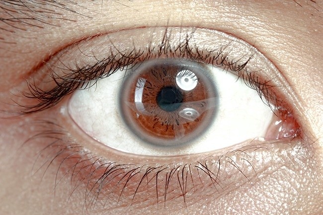 2. Biały okrąg wokół tęczówki oka.