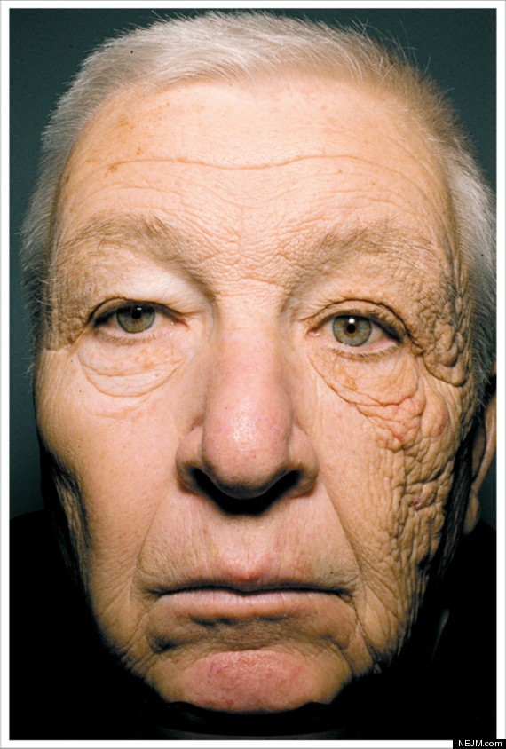 Zniszczona przez słońce twarz kierowcy po 30 latach pracy