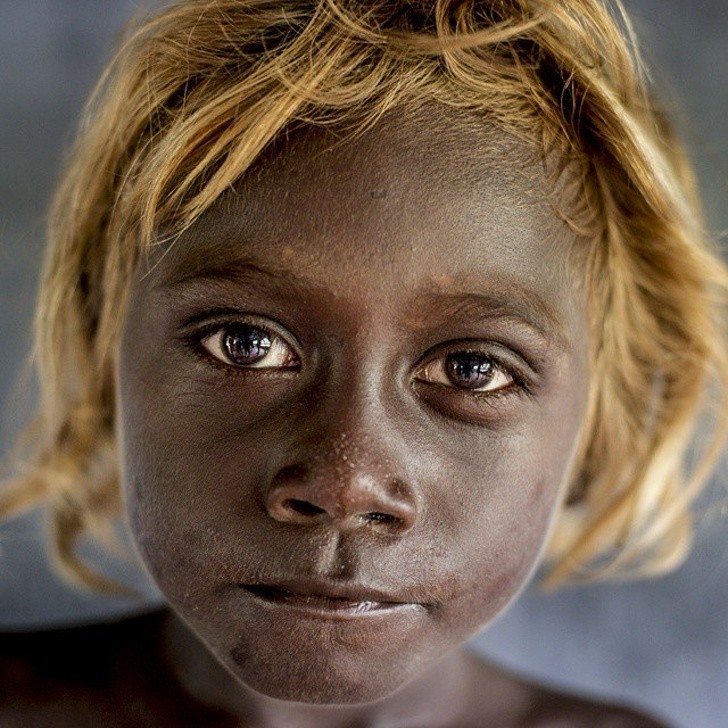16. Czarnoskórzy mieszkańcy Wysp Salomona posiadają gen, który sprawia, że rodzą się oni z blond włosami.