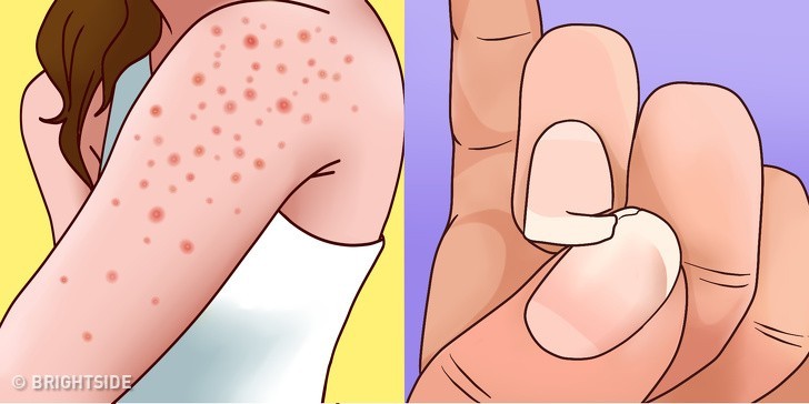  5. Problemy ze skórą i paznokciami
