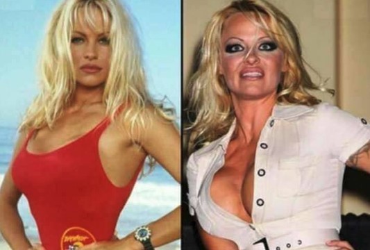 10. Pamela Anderson