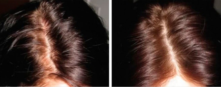5. Suchy szampon na błyskawiczne odświeżenie włosów