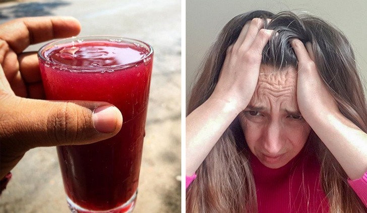 1. Sok winogronowy pomoże ci pozbyć się ataków migreny