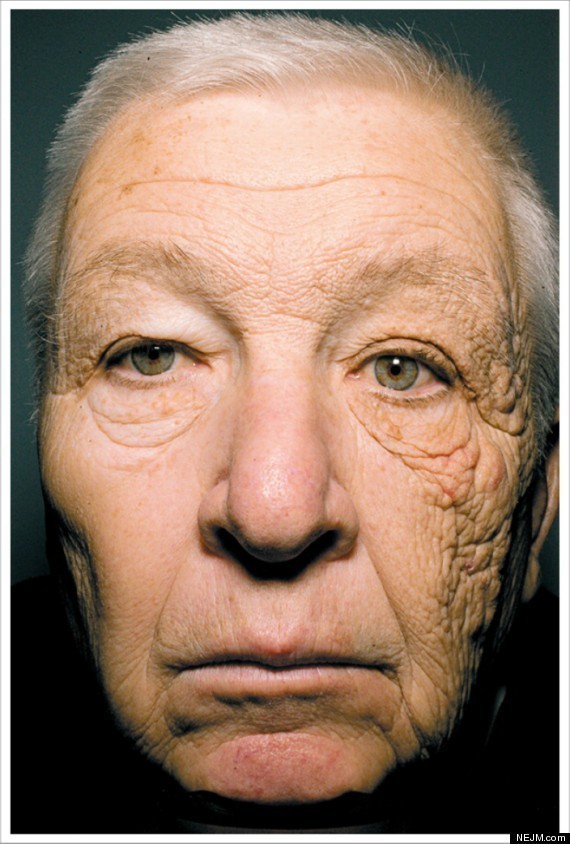 15. Zniszczona przez słońce twarz kierowcy po 30 latach pracy