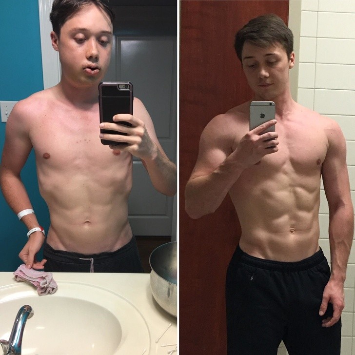 "Przed i po operacji szczęki. W ciągu 5 miesięcy przybyło mi też nieco mięśni."