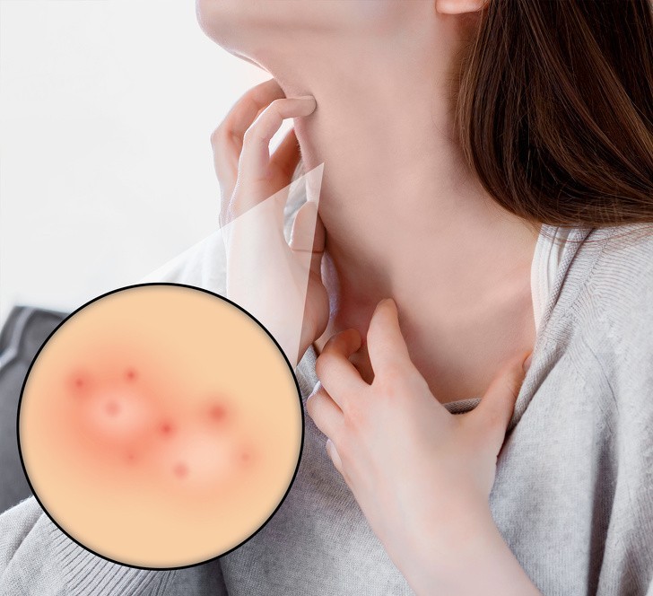 5. Alergie i inne dolegliwości skórne