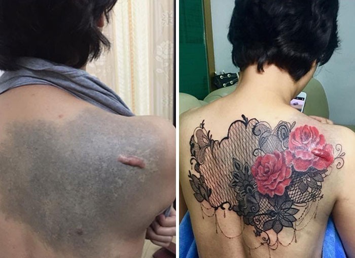 Artystka, posługująca się w mediach społecznościowym pseudonimem Ngoc, poświęca dużo czasu na projektowanie tatuaży dla osób pragnących ukryć blizny.