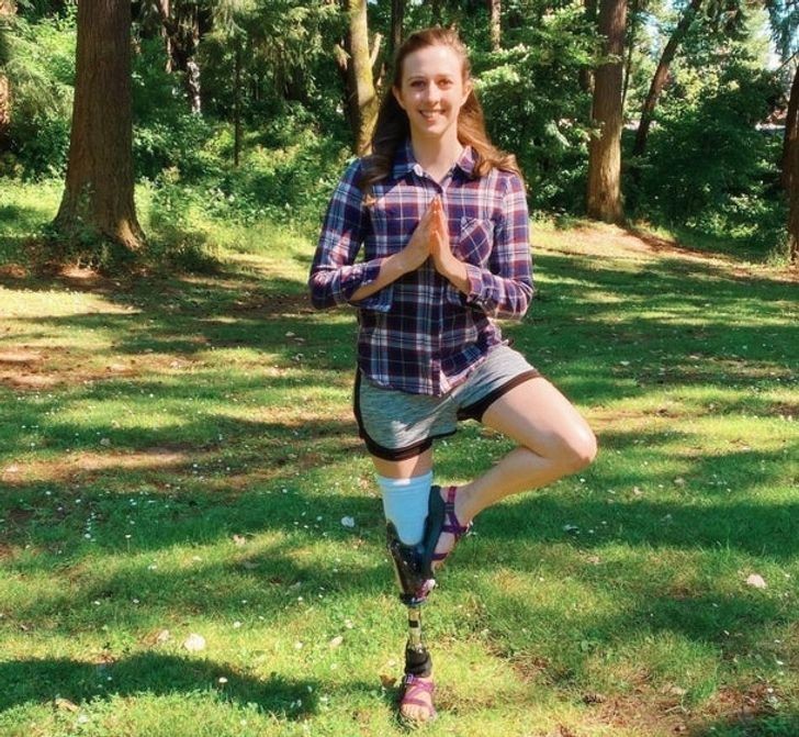 "Nie mogłam nosić mojej protezy przez ponad 40 dni. Nigdy nie przestanę doceniać faktu, że jestem w stanie chodzić o własnych siłach."