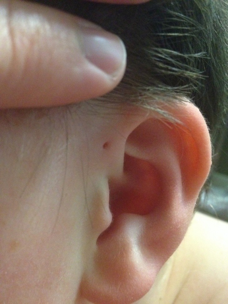 16. Niektórzy wierzą, że te dziurki w uszach to ewolucyjna pozostałość po skrzelach.