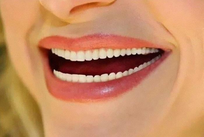 Jedna z reklam wybielania zębów