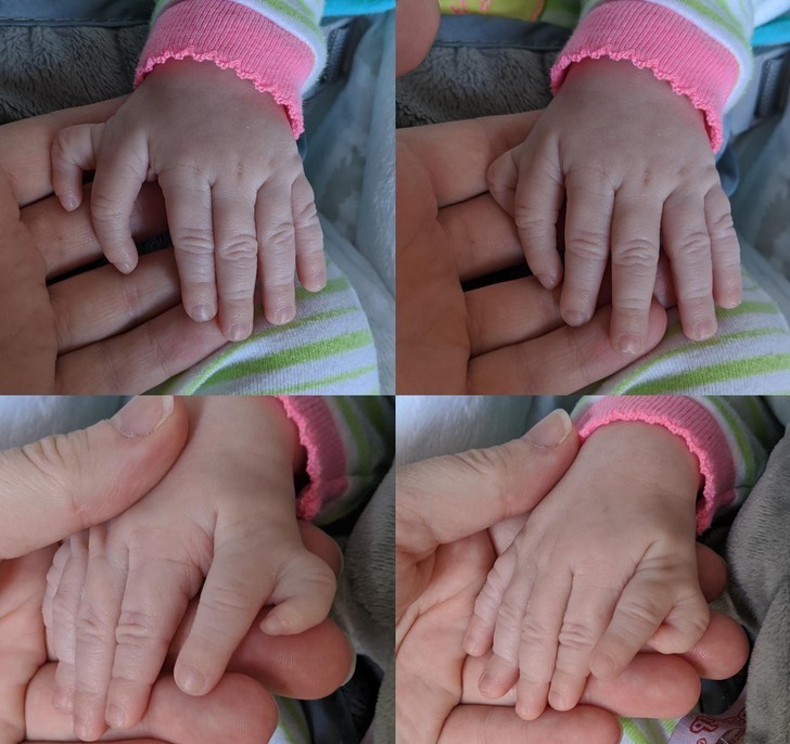 11. "Moja najmłodsza córka urodziła się z sześcioma palcami u każdej dłoni."