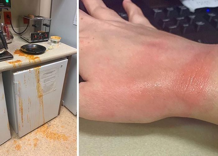 6. "Oparzyłem rękę wyjmując zupę z mikrofalówki, bo przestraszył mnie dźwięk tostera."