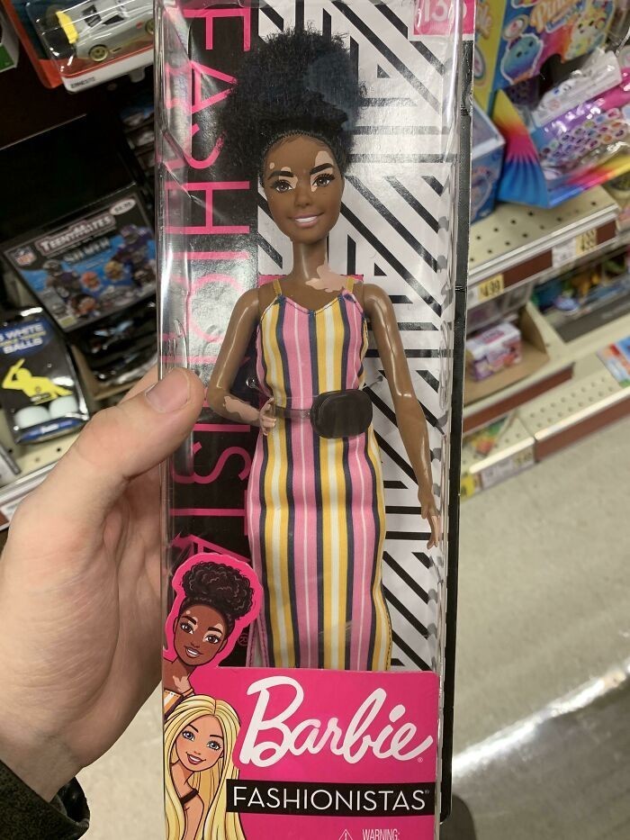 Barbie z bielactwem