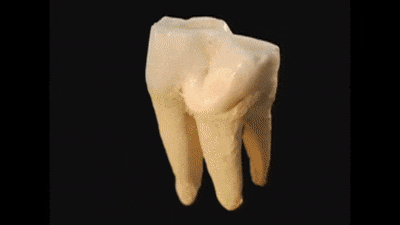 6. Ząb powiększony do poziomu atomów