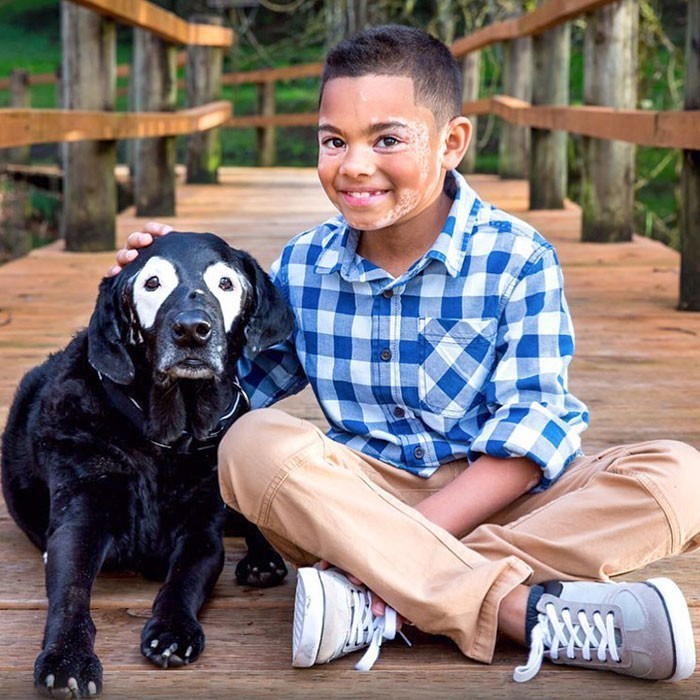 8-letni Carter Blanchard i jego pies Rowdy obaj chorują na bielactwo