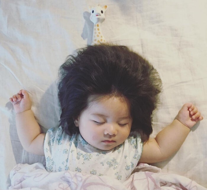 To dziecko urodziło się z niewiarygodną ilością włosów. Na tym zdjęciu ma 7 miesięcy.