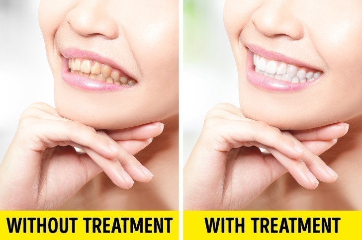 4. Jakość usług dentystycznych uległa poprawie.