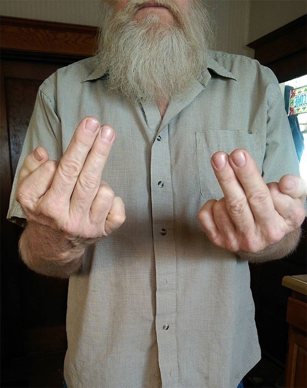 3. Mano tėtis turi 6 pirštus ant kiekvienos rankos.