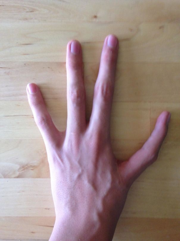 7. Mam tylko 4 palce u lewej dłoni, a zamiast kciuka mam palec wskazujący.