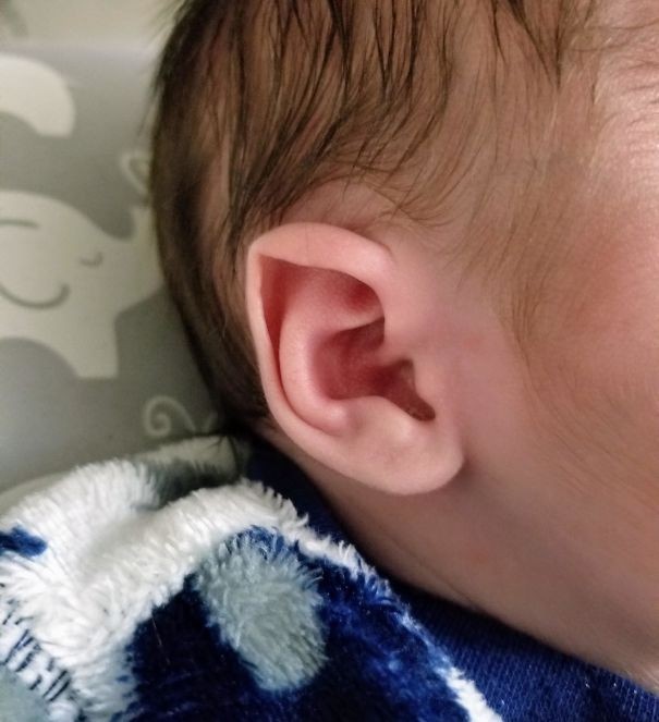 8. Mój syn urodził się z naturalnymi elfimi uszami.