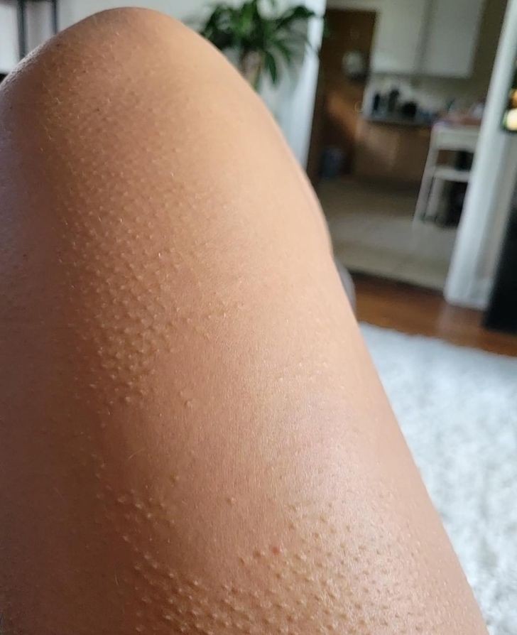 "Na tym fragmencie mojej nogi nie pojawia się gęsia skórka."