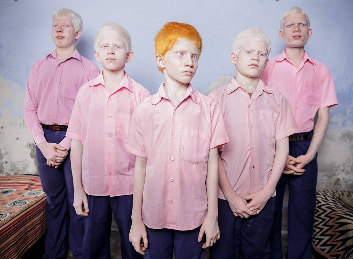 7. Niewidomi chłopcy cierpiący na albinizm, w swoim pokoju w ośrodku misyjnym w Indiach.