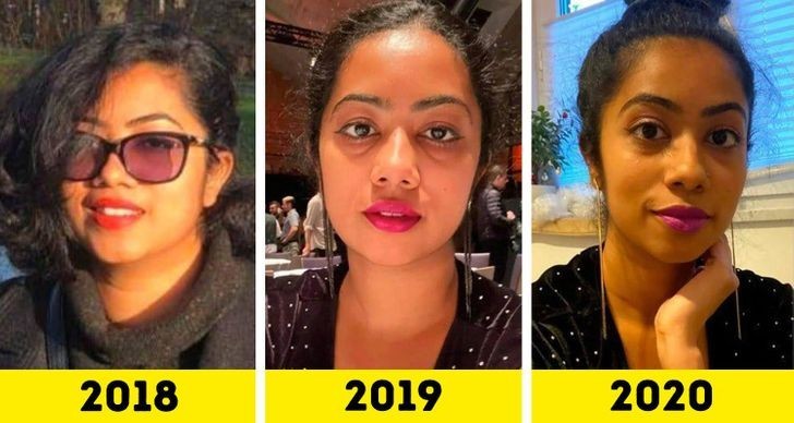 2. "3 lata odzyskiwania smukłych rysów twarzy"