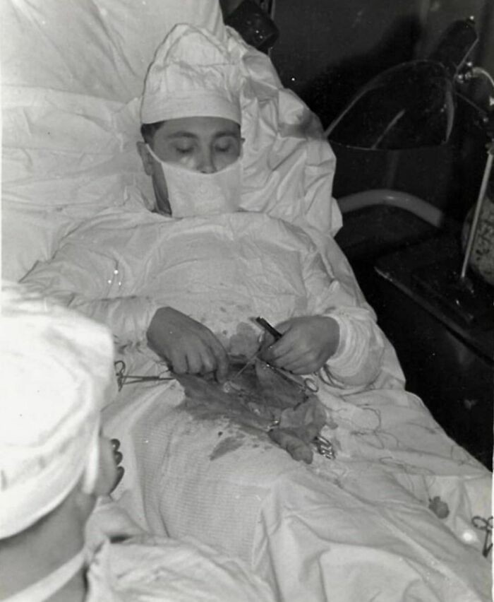 27-letni chirurg Leonid Rogozow przeprowadził na sobie operację wycięcia wyrostka podczas radzieckiej ekspedycji antarktycznej w 1961 roku. Był tam jedynym lekarzem.