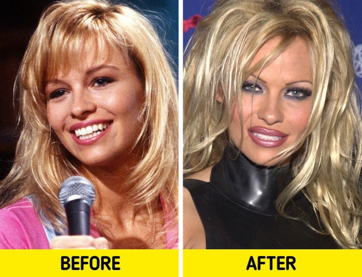 Pamela Anderson: permanentne konturowanie ust