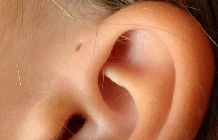 7. Mniej niż 1% ludzi posiada te małe dziurki na uszach. Niektórzy naukowcy twierdzą, że są to ewolucyjne pozostałości skrzeli.