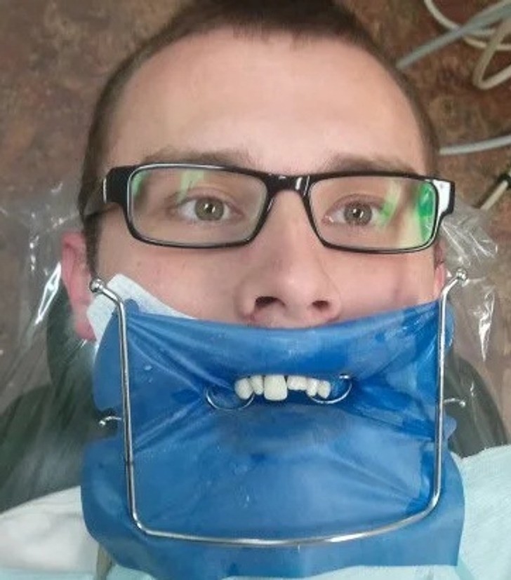 "Złamałem przedni ząb. Podczas wizyty u dentysty poprosiłem o zdjęcie w trakcie zabiegu."