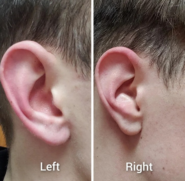 "Moje uszy mają różny kształt. Słuchawki pasują tylko do lewego."