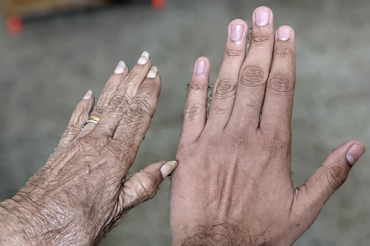 "Dłoń mojej babci i moja. Ponad 60 lat różnicy wieku"