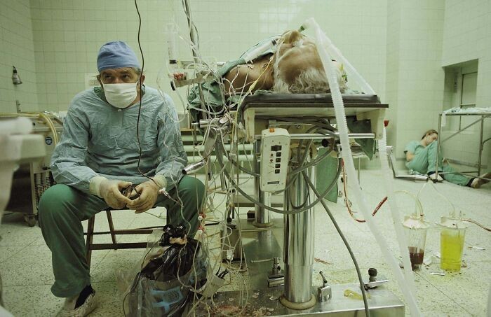 Zbigniew Religa siedzący przy pacjencie po 23-godzinnej operacji przeszczepu serca. W kącie śpi jego wyczerpany asystent. 1987 rok