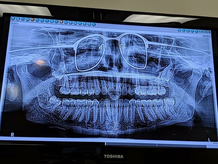 "Dentysta zapomniał powiedzieć mi, bym zdjął okulary przed prześwietleniem."