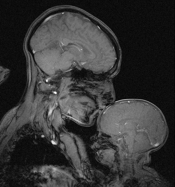 5. Kobieta z dzieckiem na zdjęciu rentgenowskim