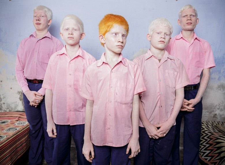 Niewidomi chłopcy cierpiący na albinizm, w swoim pokoju w ośrodku misyjnym w Indiach