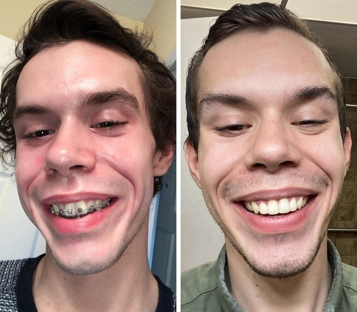 7. "Chciałem tylko podziękować mojemu ortodoncie, który podarował mi normalny uśmiech."