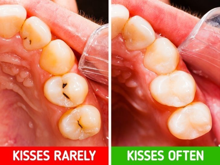 5. Twoje zęby będą mniej podatne na powstawanie ubytków.