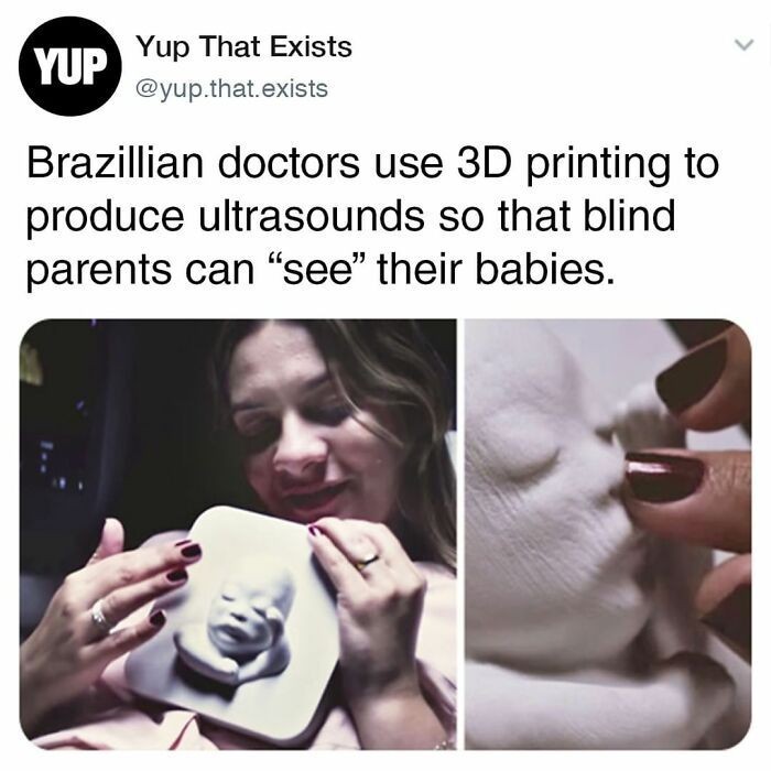 6. Brazylijscy lekarze wykorzystują technologię drukowania 3D przy badaniach USG, by niewidomi rodzice mogli "zobaczyć" swoje dzieci.
