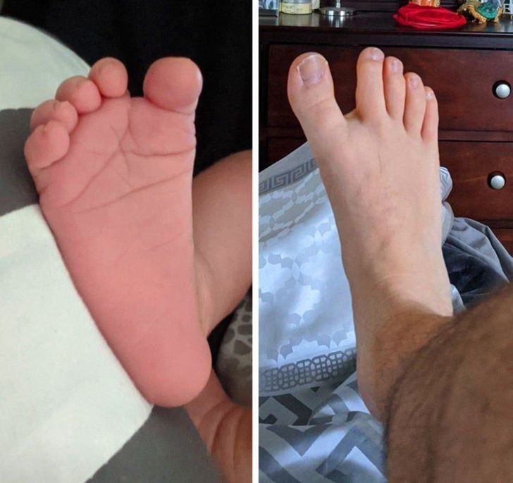 13. "Mój syn urodził się z tak samo dziwnie rozstawionymi palcami u stóp, co ja."