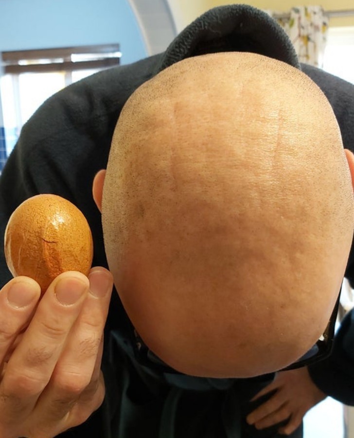 1. "To dziwne pomarszczone jajko pasuje do dziwnej pomarszczonej głowy mojego męża."