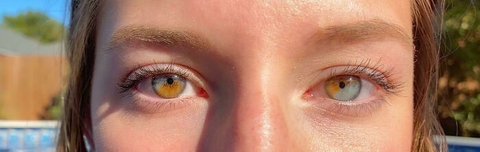 15. "Mam częściowo różnobarwne oczy."