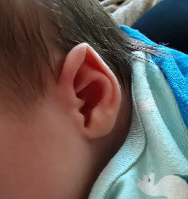 9. "Moje dziecko ma elfie ucho."