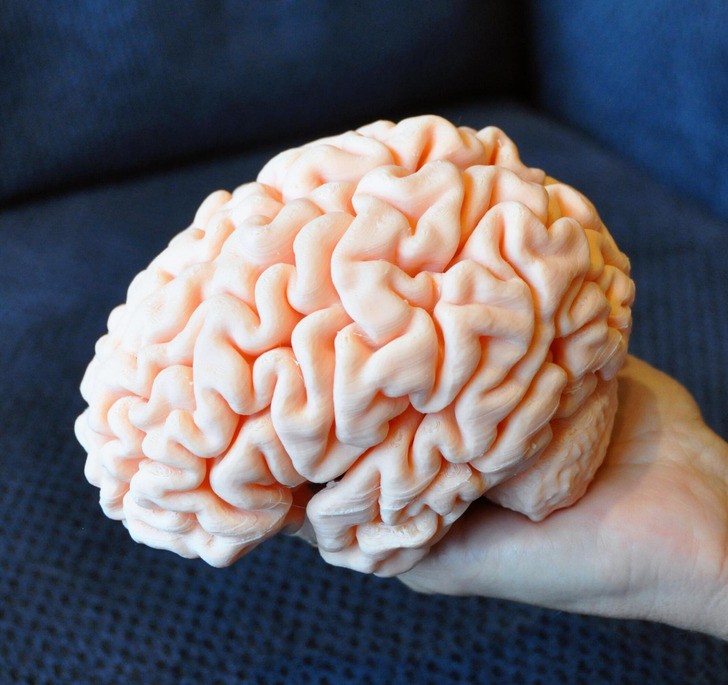 "Wydrukowałem mózg mojego syna w drukarce 3D na podstawie jego MRI.