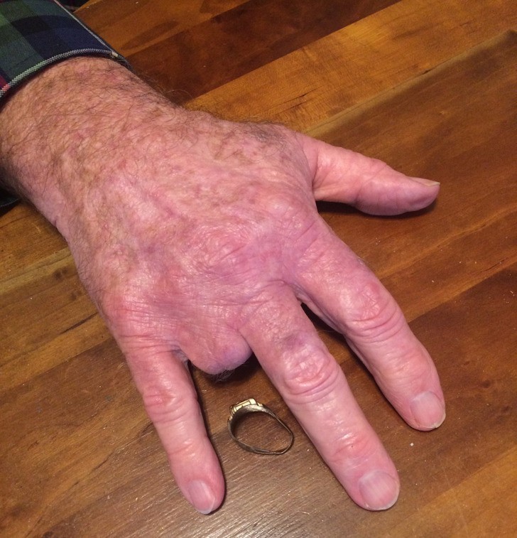15. "Mój dziadek stracił palec 50 lat temu. Po latach, mój wujek znalazł jego pierścień wykrywaczem metalu."