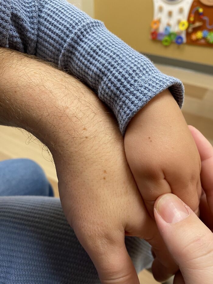 "Ja i mój syn mamy takie same dwa pieprzyki na naszych dłoniach."