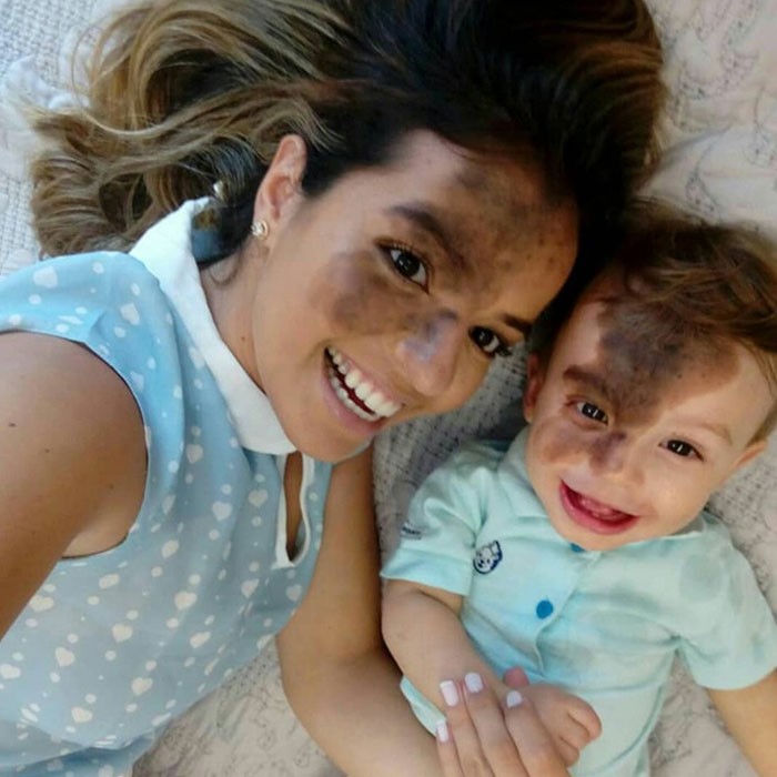 "Mama namalowała duże znamię na swojej twarzy, by dopasować się do swojego syna."