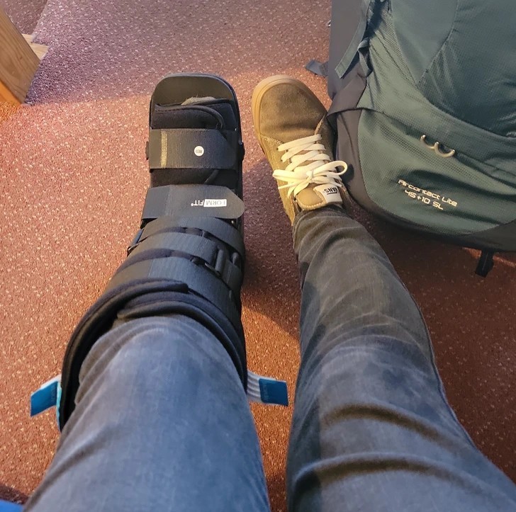 "Złamałem stopę 7 dnia mojej 24-dniowej wycieczki po Wielkiej Brytanii."